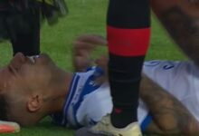 quedó internado en terapia intensiva